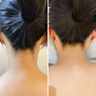 うなじ脱毛/美肌脱毛 LABELのエステ・リラクイメージ