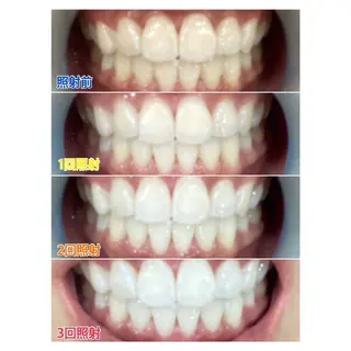 MBEAUTYSALON 千葉店・京成大久保所属・Melty 輝のその他イメージ