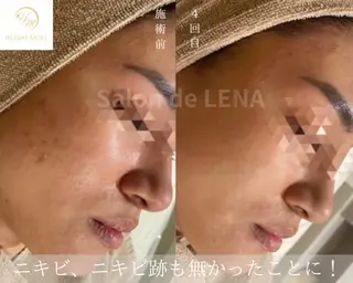 サロンドレナ名駅店所属・ハーブピーリング専門 サロンドレナ平岡のエステ・リラクイメージ