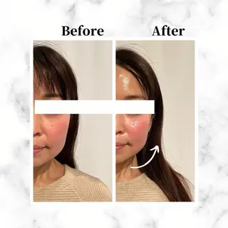 12Dハイフ💗 最強小顔のエステ・リラクイメージ