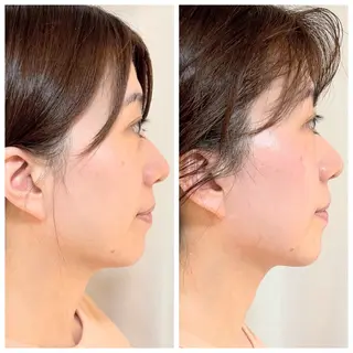 LaLa所属・小顔・たるみケア 専門店【&LaLa】のエステ・リラクイメージ