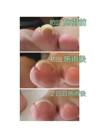 ネイル Takasaki Keikoのネイルデザイン