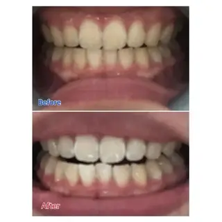 M渋谷店所属・M渋谷 ホワイトニングのエステ・リラクイメージ