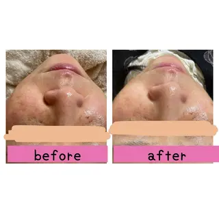 毛穴・リンパ・肌ケア サロン スリールのエステ・リラクイメージ