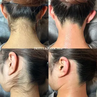 HOTEL&PARK .Moeワックス脱毛のエステ・リラクイメージ