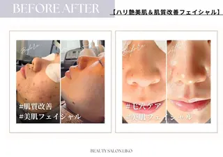 Beauty salon  Liko所属・LIKO フェイシャル&ボディのエステ・リラクイメージ