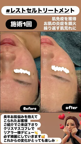 LiZA エステティックサロンのエステ・リラクイメージ