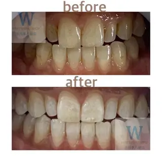 ホワイトニング ショップ本八幡店のエステ・リラクイメージ