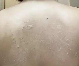 clé skin 🌿ハーブピーリングのエステ・リラクイメージ