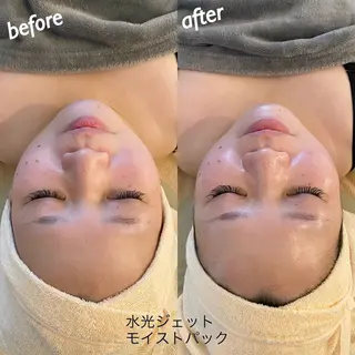 うなじ脱毛/美肌脱毛 LABELのエステ・リラクイメージ