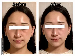 小顔矯正Sho  FaceDesignのエステ・リラクイメージ