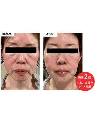 シミ・若返り特化 さゆみのエステ・リラクイメージ