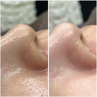 マツエク・マツパ リラクゼーション＆エステランベリー所属・ランベリ ランベリのエステ・リラクイメージ