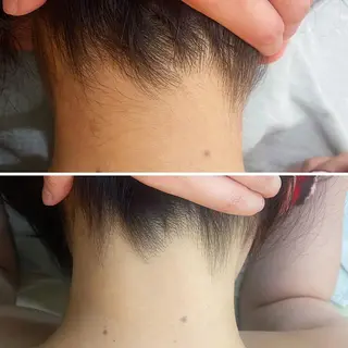 うなじ脱毛/美肌脱毛 LABELのエステ・リラクイメージ