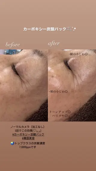 BIREINA Eyelash  Salon所属・BIREINA 住之江公園のマツエク・マツパデザイン