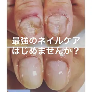 ネイル 奥園 良恵のネイルデザイン