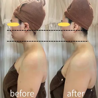 aliaハイフ&水光ジェットサロン所属・aliaハーブ水光店 エステティシャン募集のエステ・リラクイメージ