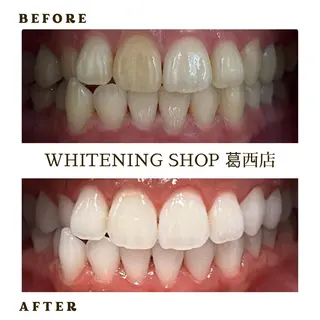 メンズ ホワイトニング ショップ葛西店のその他イメージ