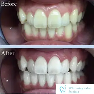 セルフホワイトニングサロンfascimo所属・ホワイトニングサロン fascimo新座店のその他イメージ