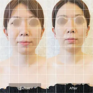 小顔・美肌ケア専門 Diva北浜のエステ・リラクイメージ