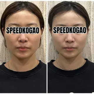 小顔矯正Speed KOGAO渋谷本店のエステ・リラクイメージ