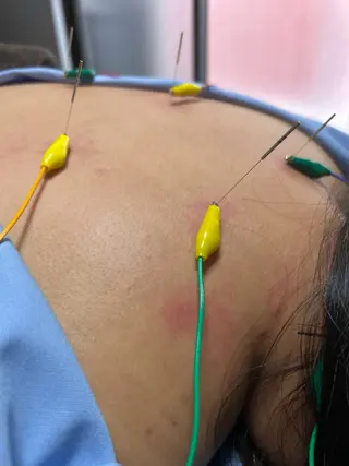 clear所属・clear鍼灸院 清水【吉祥寺】のエステ・リラクイメージ