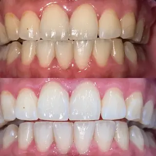 𓂃𓂂ꕤ*.ﾟFullcover𓂃𓂂ꕤ*.ﾟbeauty所属・Fullcover beautyのその他イメージ