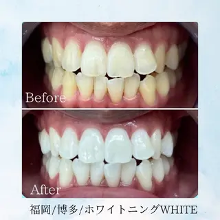 セルフホワイトニング WHITE福岡博多店のエステ・リラクイメージ