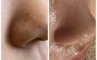 デ・アイム赤城所属・ナリス化粧品🌹 saoriのエステ・リラクイメージ