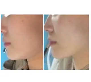 NAZ  (ナーズ)のエステ・リラクイメージ