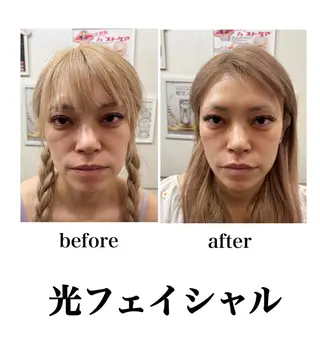 毛穴改善/脱毛 ネイル　川上久仁子のエステ・リラクイメージ