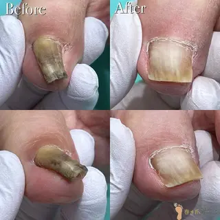 東京巻き爪アカデミー所属・東京巻き爪 アカデミーのエステ・リラクイメージ