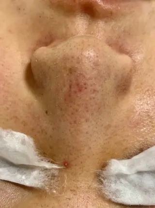 麻布十番エステサロン WhiteAzabuのエステ・リラクイメージ