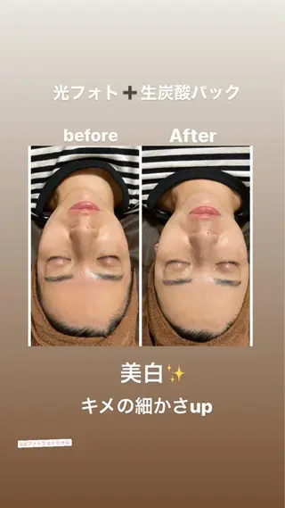 美顔秘密基地新宮所属・美顔秘密基地 新宮のその他イメージ