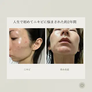 奥村 まよのエステ・リラクイメージ