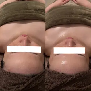 LIAN  Beauty Salon所属・LIAN リアンのエステ・リラクイメージ