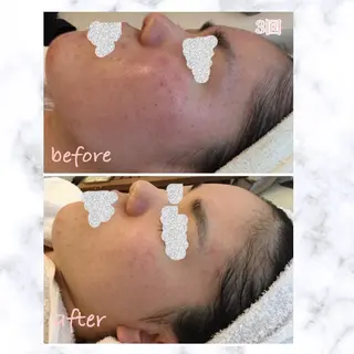 BLOOM〜 天恵（てんのめぐみ）のエステ・リラクイメージ