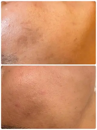 調律エステ /美KISSのその他イメージ