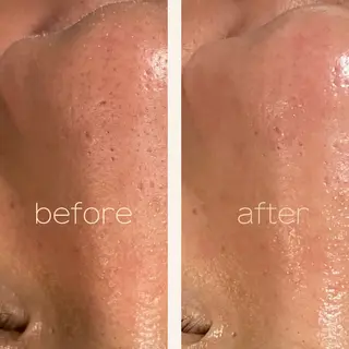 Luce所属・Luce Shokoのエステ・リラクイメージ