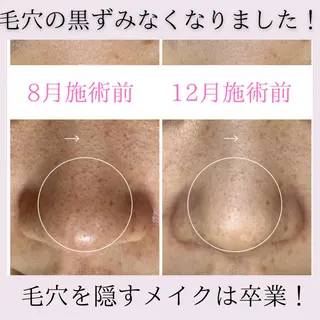 毛穴ケア専門サロンアンスリウム所属・茨城土浦 つくば毛穴 ケア専門サロンのエステ・リラクイメージ