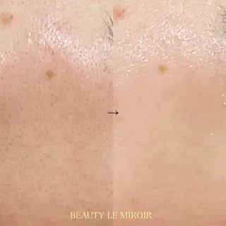 ビューティー ミロワールのエステ・リラクイメージ