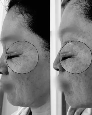 〈etre〉トータルビューティーサロン所属・etre - 韓国肌管理 -のエステ・リラクイメージ