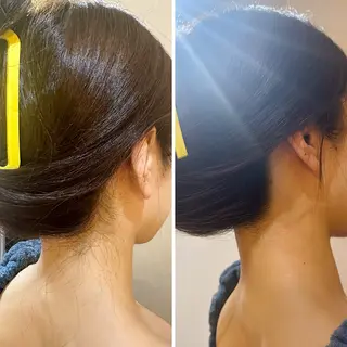 うなじ脱毛/美肌脱毛 LABELのエステ・リラクイメージ