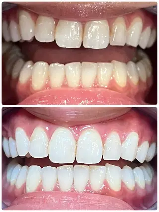 ベルーテ エッセンスのエステ・リラクイメージ