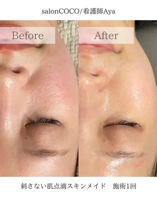 salonCOCO所属・肌管理看護師💎 salonCOCOのエステ・リラクイメージ