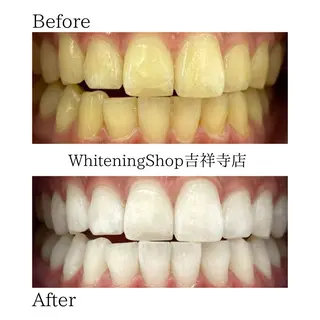 ホワイトニング ショップ吉祥寺店のエステ・リラクイメージ