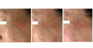 ヴィーナス ビューティーのエステ・リラクイメージ