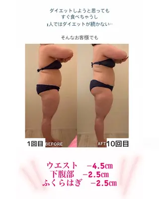 産後ダイエット−9㎏ Pourvous結衣のエステ・リラクイメージ