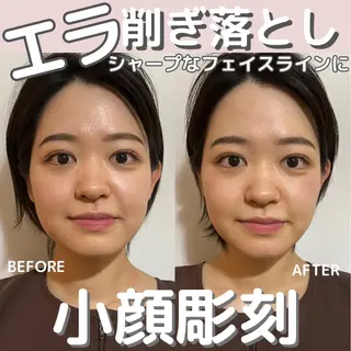 小顔矯正/骨格矯正 AKANEのエステ・リラクイメージ