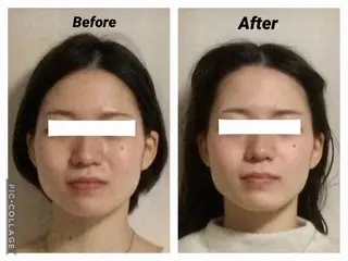 小顔矯正Sho  FaceDesignのエステ・リラクイメージ